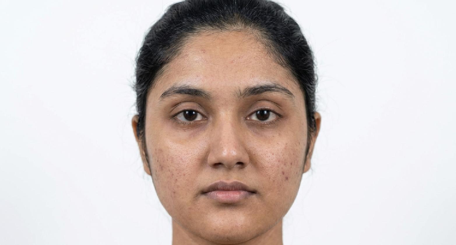 BioCare Vitamin C Whitening Facial Cream