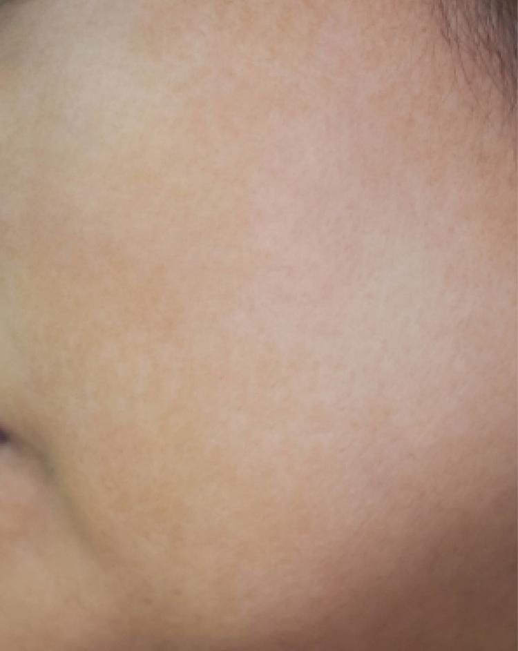 after-image