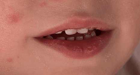 Bebble Facial Cream