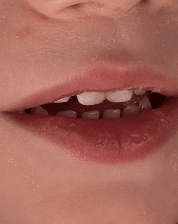 after-image
