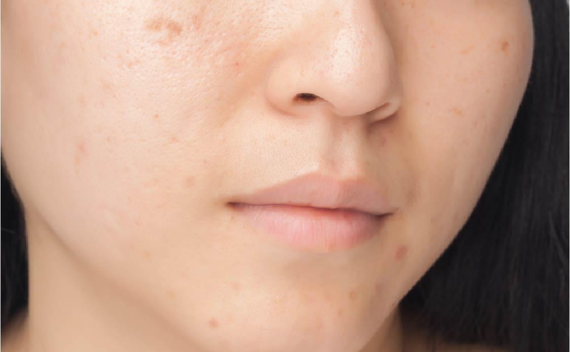 Dermedic Sunbrella Ultra-light Fluid SPF 50+ oily and combination skin