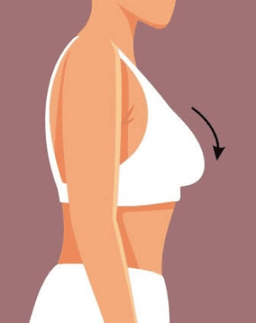 after-image