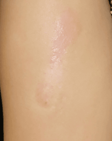after-image