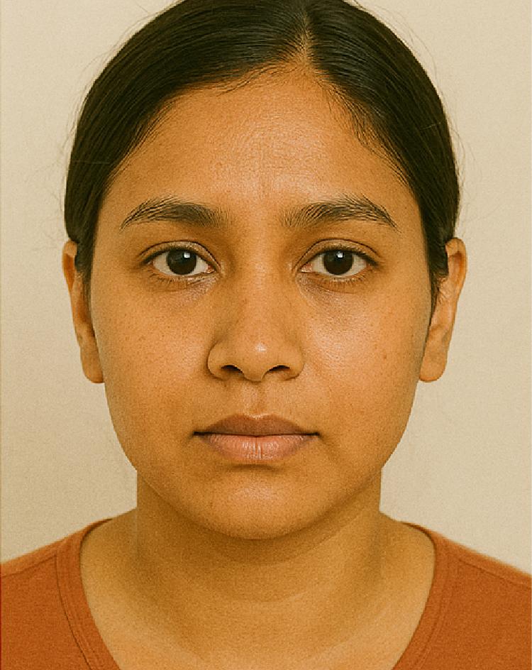 after-image