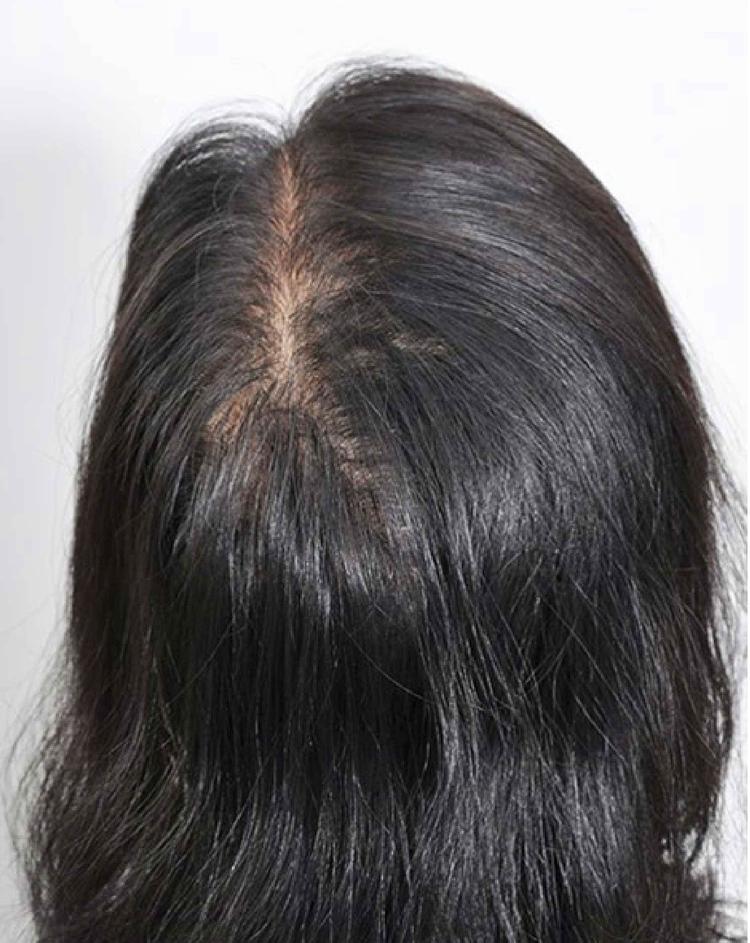 after-image